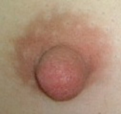右奶头