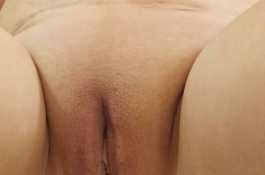 無毛穴