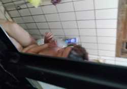 乳頭快要斷掉 嗎今天3公升排光