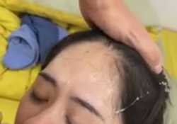 删